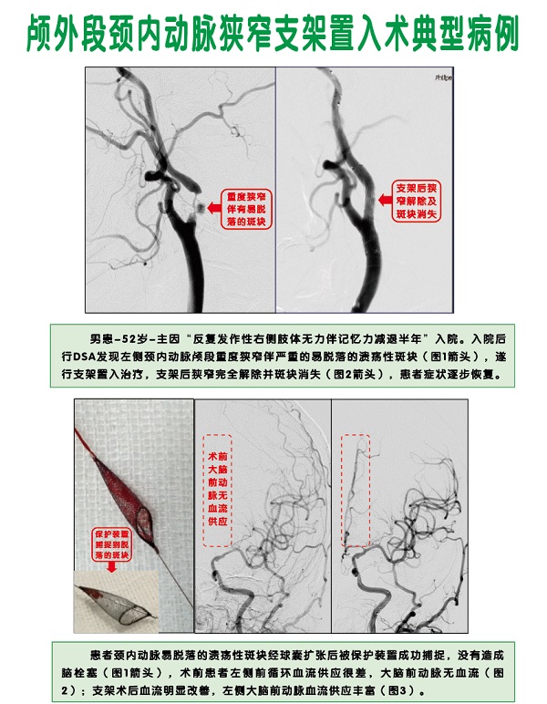 神经内科2.jpg